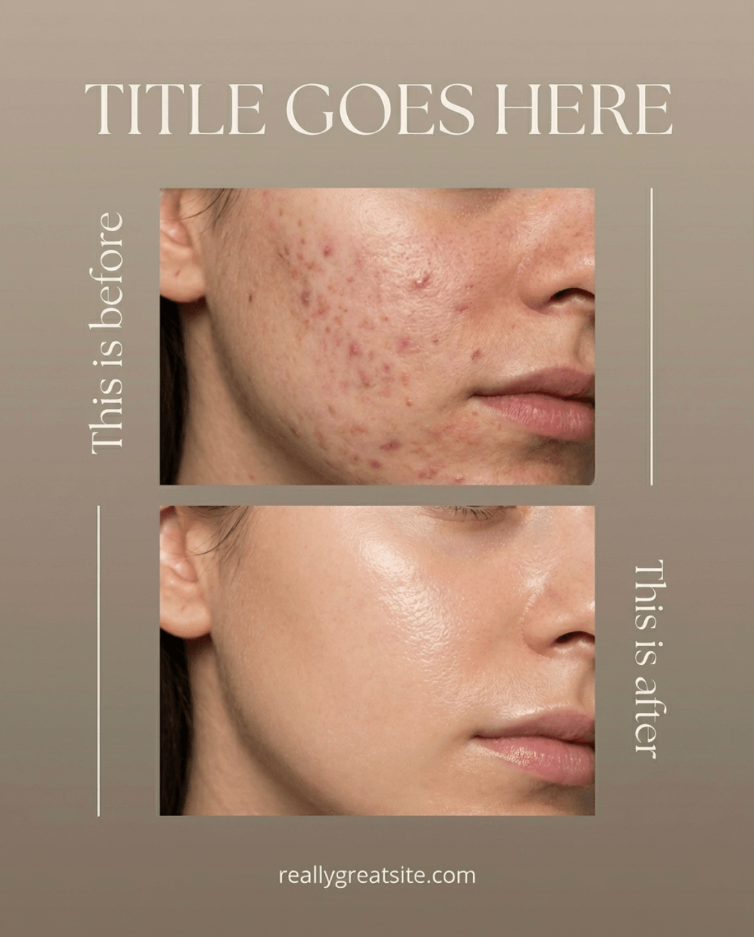 Skin Health — Healthcare social post example